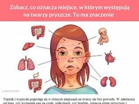 Zobacz, co oznacza miejsce, w którym występują na twarzy pryszcze. To ma znaczenie!