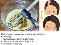 Dzięki tym 3 składnikom Twoje włosy w mgnieniu oka urosną silne i grube!