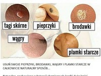 Usuń swoje pieprzyki, brodawki, wągry i plamki. NATURALNY sposób!