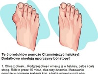 Te 5 produktów pomoże Ci zmniejszyć haluksy i zniwelować ból!