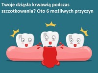 Twoje dziąsła krwawią podczas szczotkowania? Oto 6 możliwych przyczyn!