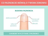 Co PAZNOKCIE mówią o twoim ZDROWIU