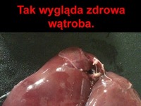 Wątroba