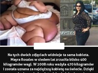 Na tych dwóch zdjęciach widnieje ta sama kobieta. Zrzuciła blisko 400 kg!