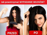 Jak powstrzymać wypadanie włosów?