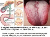 9 często przeoczanych oznak, że Twoje ciało jest pełne toksyn. Jak je oczyścić?