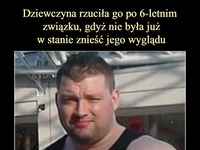 Dziewczyna rzuciła go po 6-letnim związku, gdyż nie była już w stanie znieść jego wyglądu