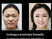 PRZEMIANA pewnej KOREANKI szokuje! Musisz zobaczyć jak ją zmienili!