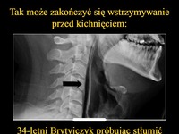 Tak może zakończyć się wstrzymywanie przed kichnięciem! Oto historia 34-letniego Brytyjczyka...