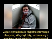 Zdjęcie przedstawia niepełnosprawnego chłopaka, który był bity, torturowany i poniżany przez czwórkę czarnoskórych oprawców!