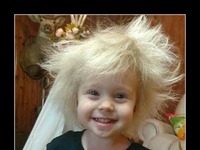 Białe włosy tej dziewczynki nie chciały opaść. Gdy lekarz ją zbadał, stwierdził, że jest jedna na milion!