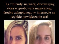 Tak zmieniły się WARGI dziewczyny, która wypróbowała magicznego środku zakupionego....! MASAKRA