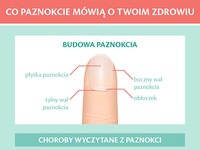 Co paznokcie mówią o Twoim zdrowiu? Zobacz koniecznie!