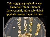 Tak wyglądają wychodowane bakterie z dłoni 8-letniej dziewczynki