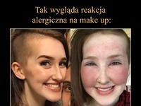 Zastanawiałaś się jak wygląda REAKCJA ALERGICZNA na make-up! To zobacz koniecznie tą dziewczynę, SZOK!