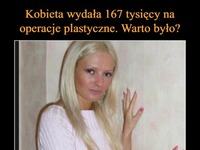 Kobieta wydała 167 tysięcy na operacje plastyczne! Warto było?