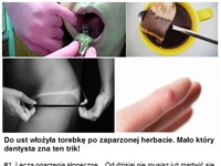 Do ust włożyła torebkę po zaparzonej herbacie. Mało który dentysta zna ten sposób