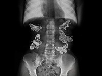 Motylki w brzuchu