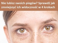 Nie lubisz swoich piegów? Sprawdź, jak zmniejszyć ich widoczność w 4 krokach!