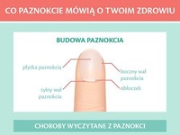 Sprawdź co PAZNOKCIE mogą  mówić o Twoim ZDROWIU! WOW